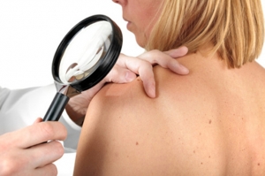 Melanomul malign : implicatii dermatologice si psihice